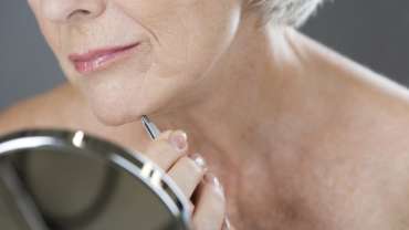 Laser za bele dlake?