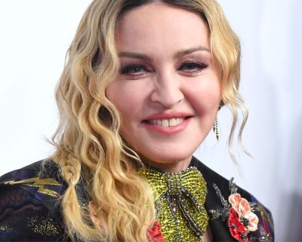 Preveč polnil in botoksa nenaraven videz otečen obraz