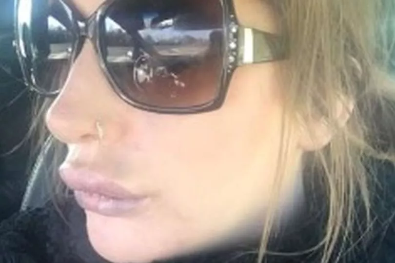 Račje ustnice duck lip preveč filerja hialuron