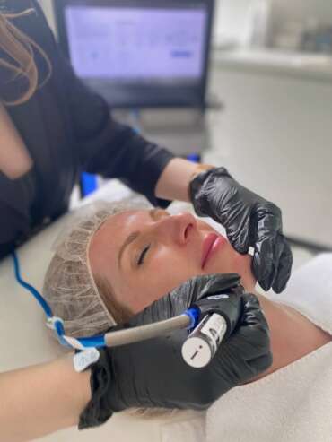 HydraFacial tretma