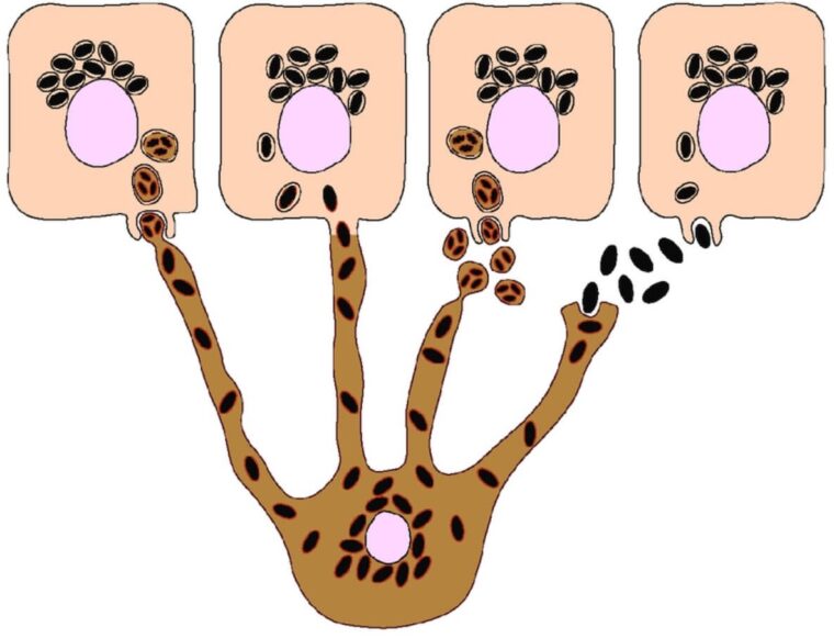 Hiperpigmentacije melanocit