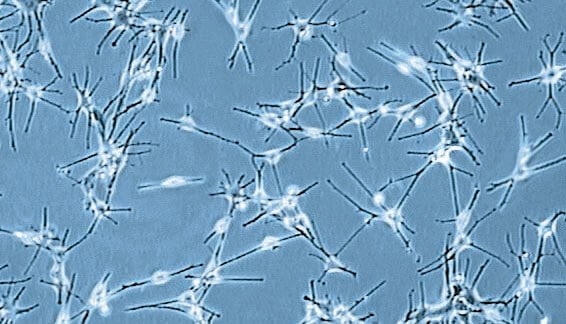 Melanociti v kulturi hiperpigmentacije